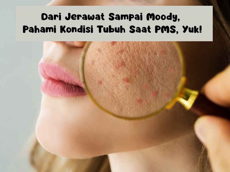 Jerawat dan moody saat pms, hadapi dengan tips ini
